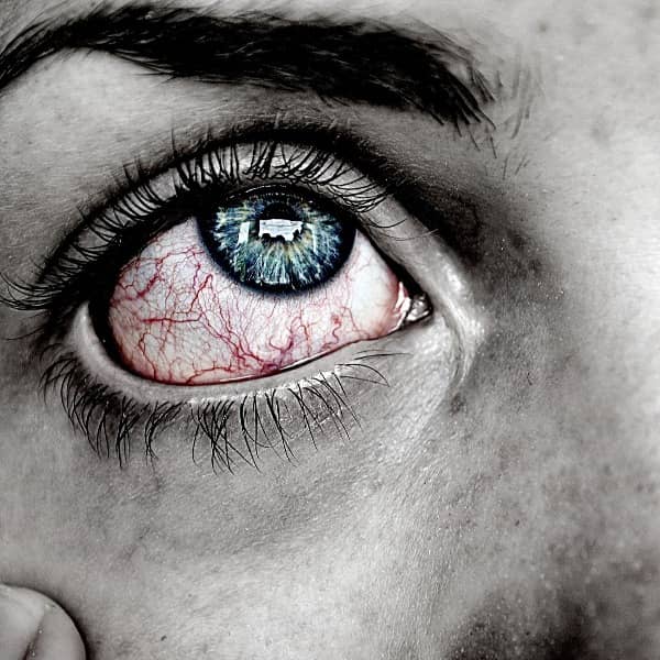 علت قرمزی چشم
